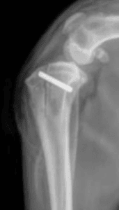 Postoperative canine knee X-ray after patellar luxation repair