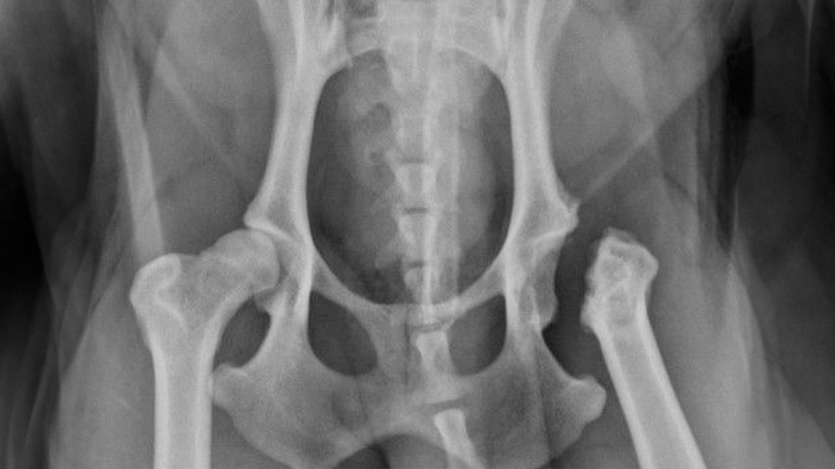 Postoperative canine hip X-ray after femoral head ostectomy surgery