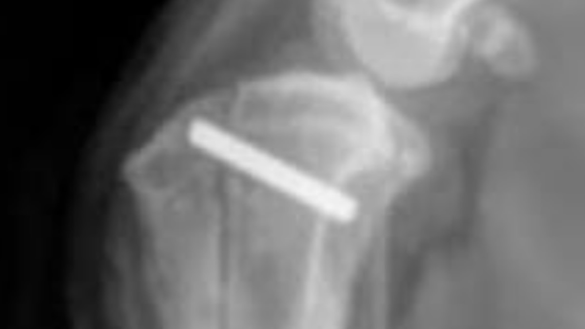 Postoperative canine knee X-ray after patellar luxation repair